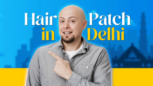 Hair Patch in Delhi