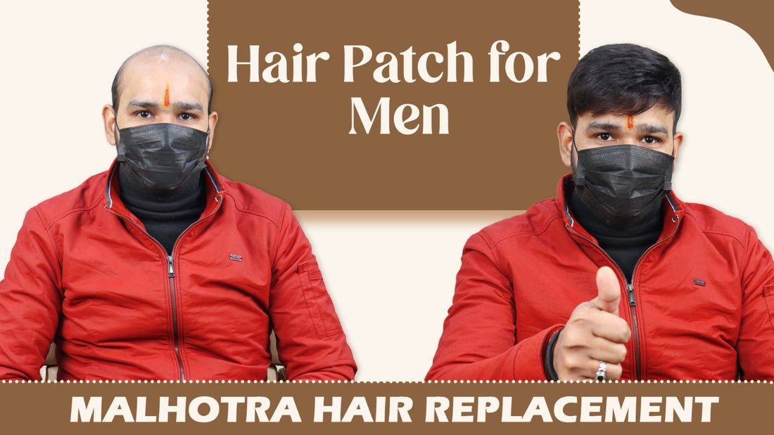 Hair Patch for Men